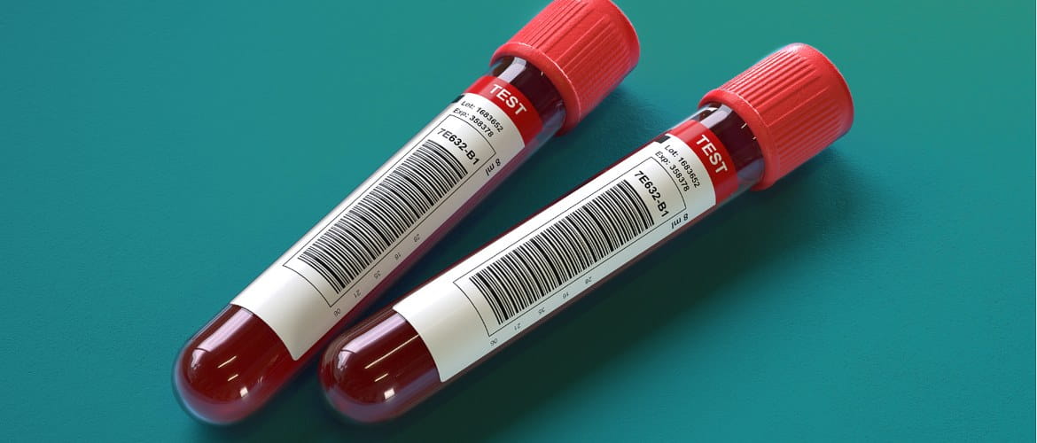 Two vacutainer blood collection test tubes are clearly marked with barcode identification labels for medical testing in a hospital healthcare environment.