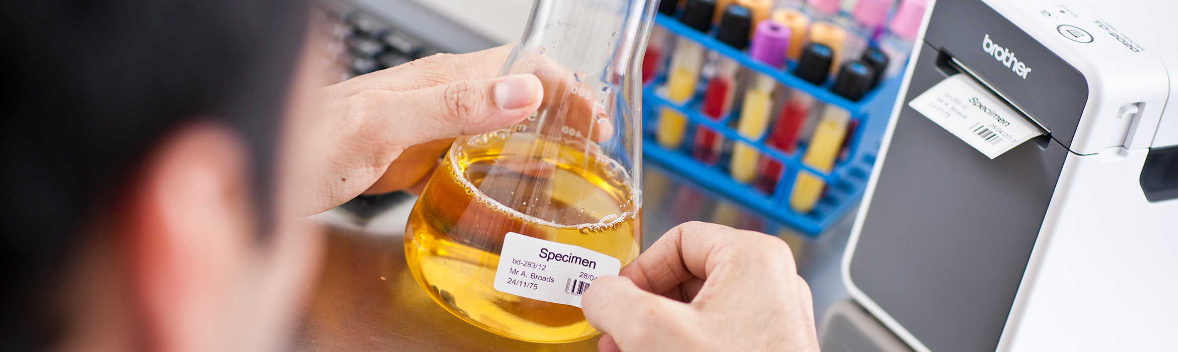 specimen-sample-label