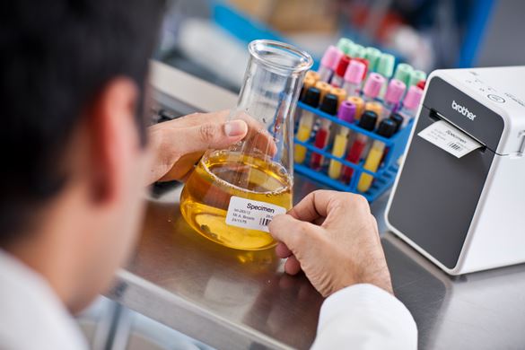 Laboratorietekniker fester en merkelapp på en beholder med en prøve