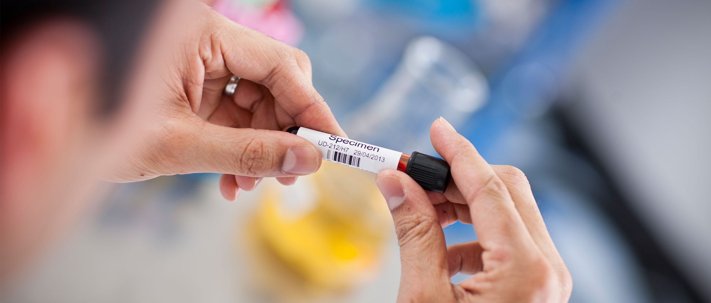 Label being put onto a hospital specimen bottle in laboratory